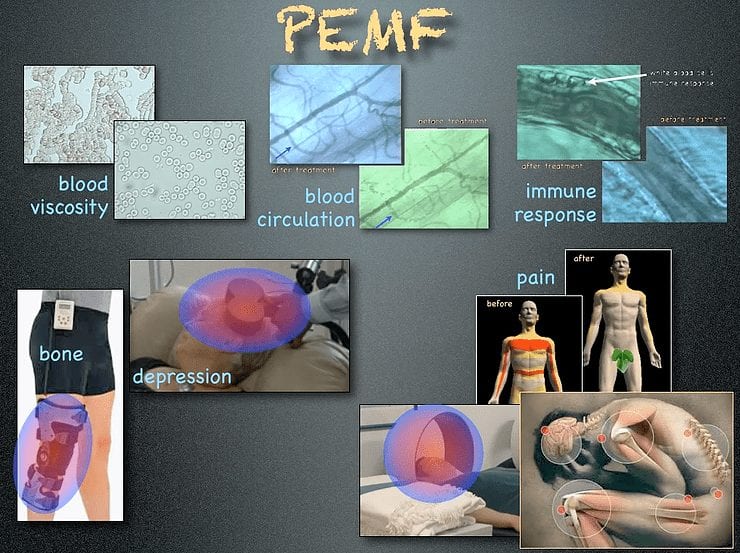 PEMF IS BELIEVED TO Assist Body Healing!